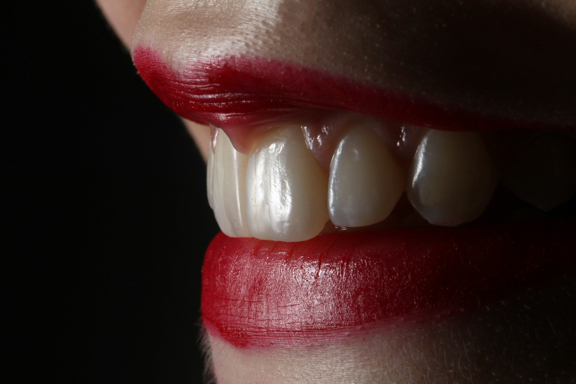 Sourire avec dents légèrement abîmées, illustrant les situations où le blanchiment dentaire est déconseillé.