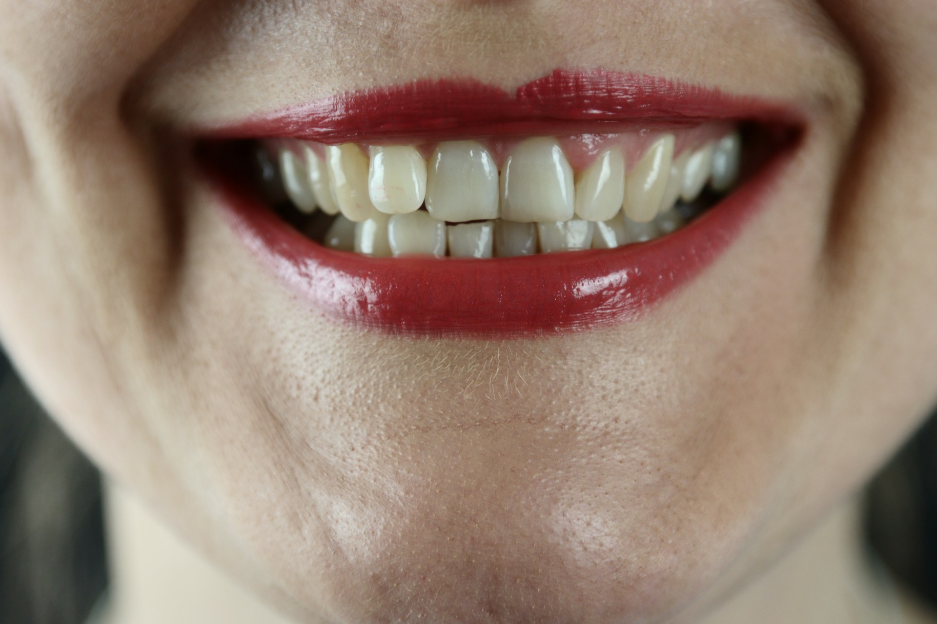 Présentation visuelle de plusieurs produits courants utilisés pour le blanchiment des dents à domicile.