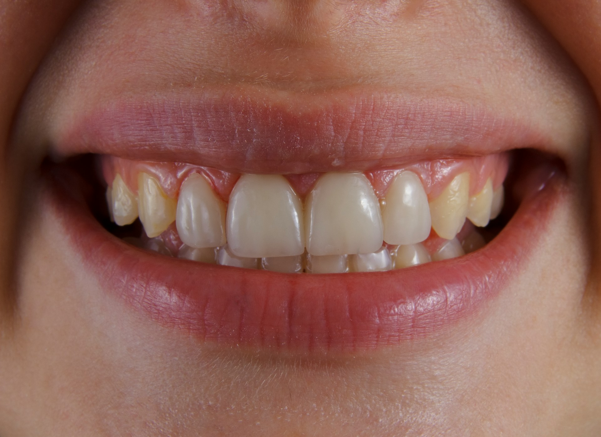Image évoquant les méthodes naturelles utilisées pour retrouver des dents plus blanches au quotidien.