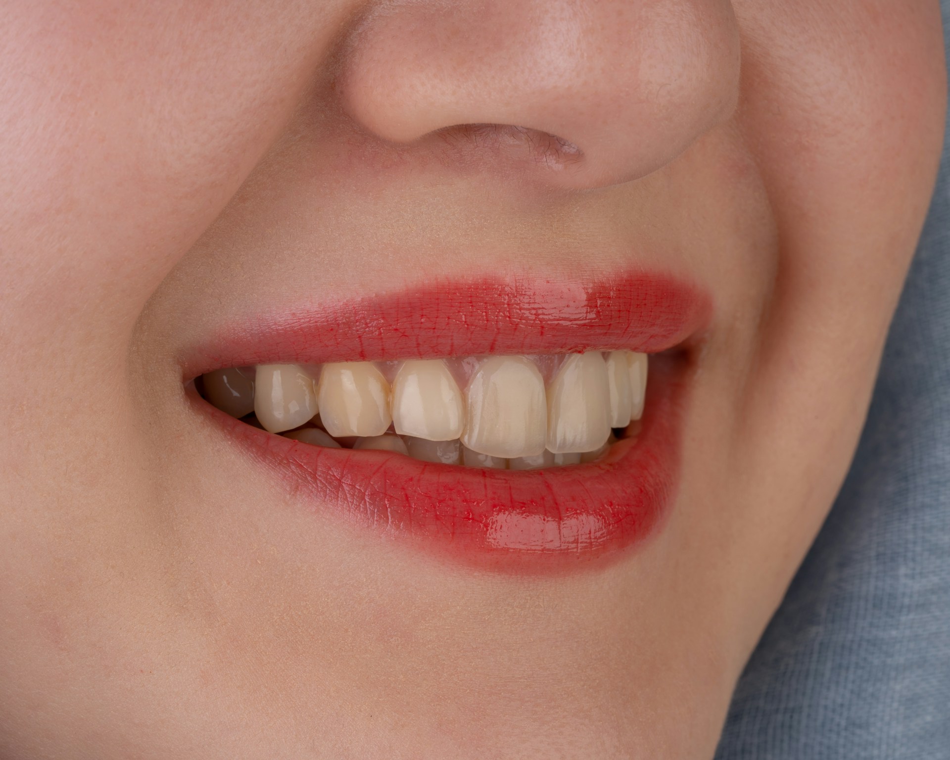 Visuel évoquant les bandes Crest Whitestrips, l'un des produits de blanchiment grand public les plus connus.
